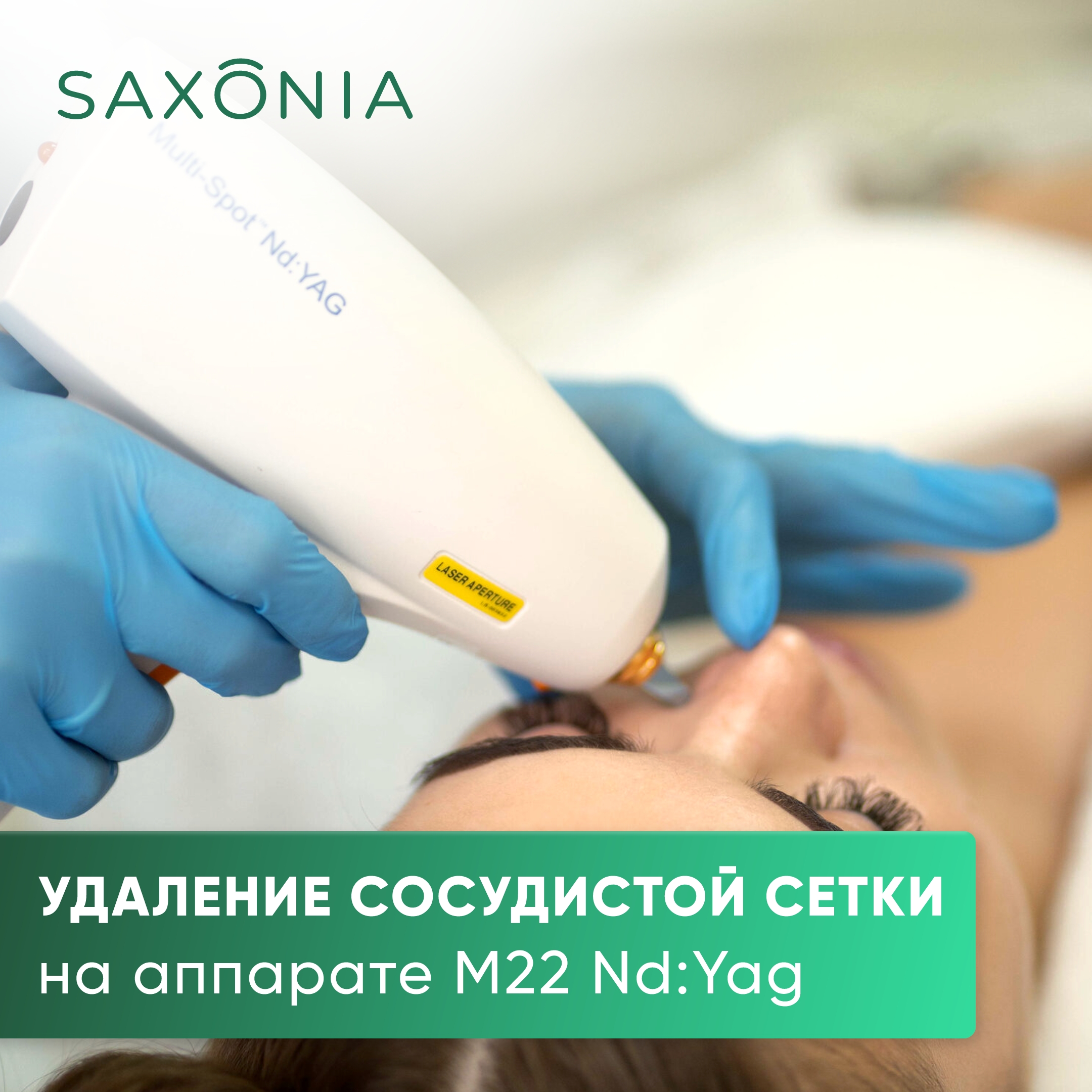 Лазерное лечение сосудистой сетки на аппарате Lumenis М22