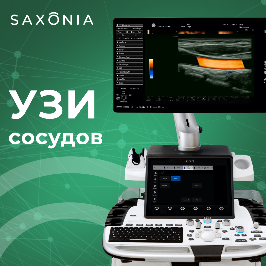 Экспертная УЗИ-диагностика сосудов на передовой ультразвуковой системе GE Logiq E10 R3!
