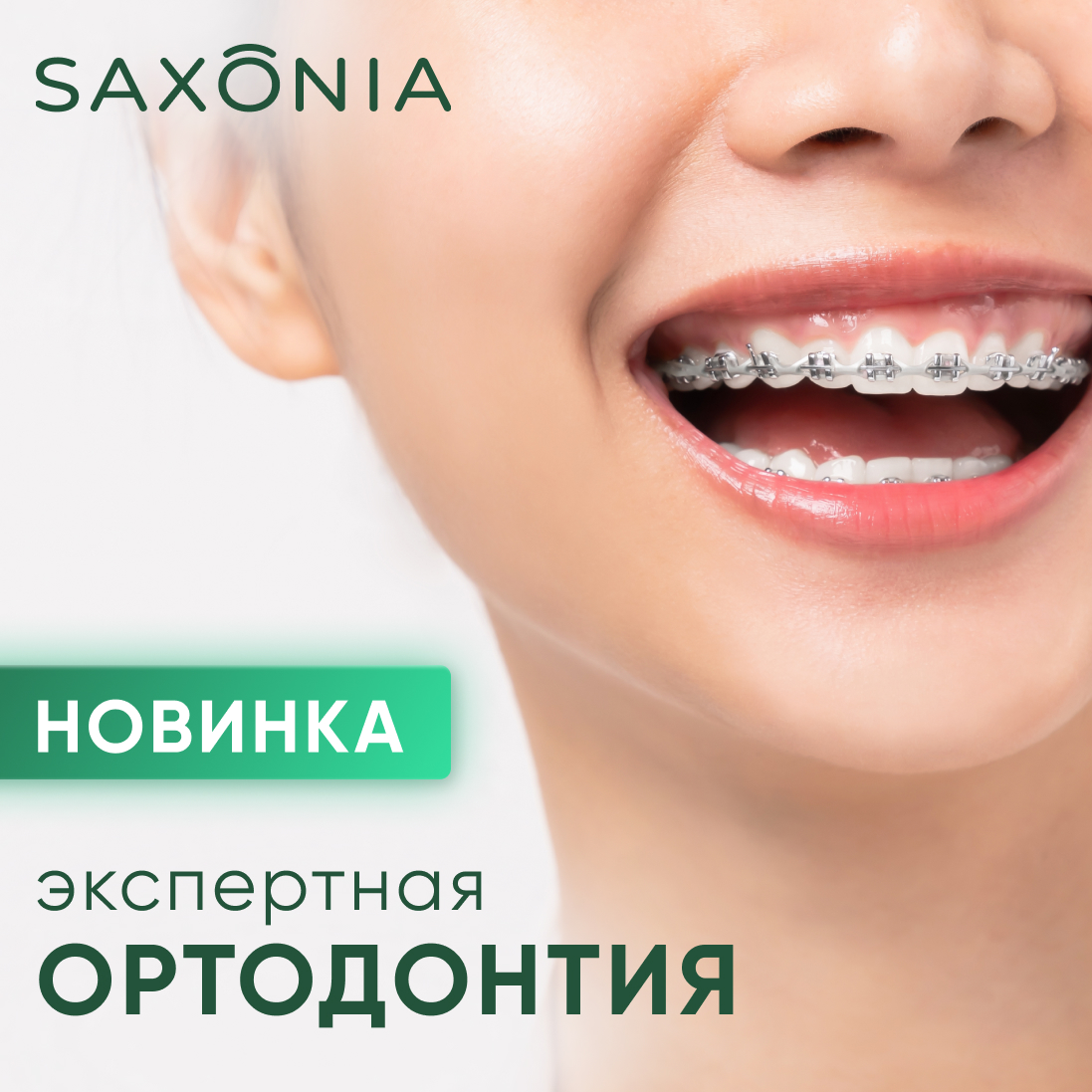 Открываем запись на ортодонтические лечение в клинике Saxonia!