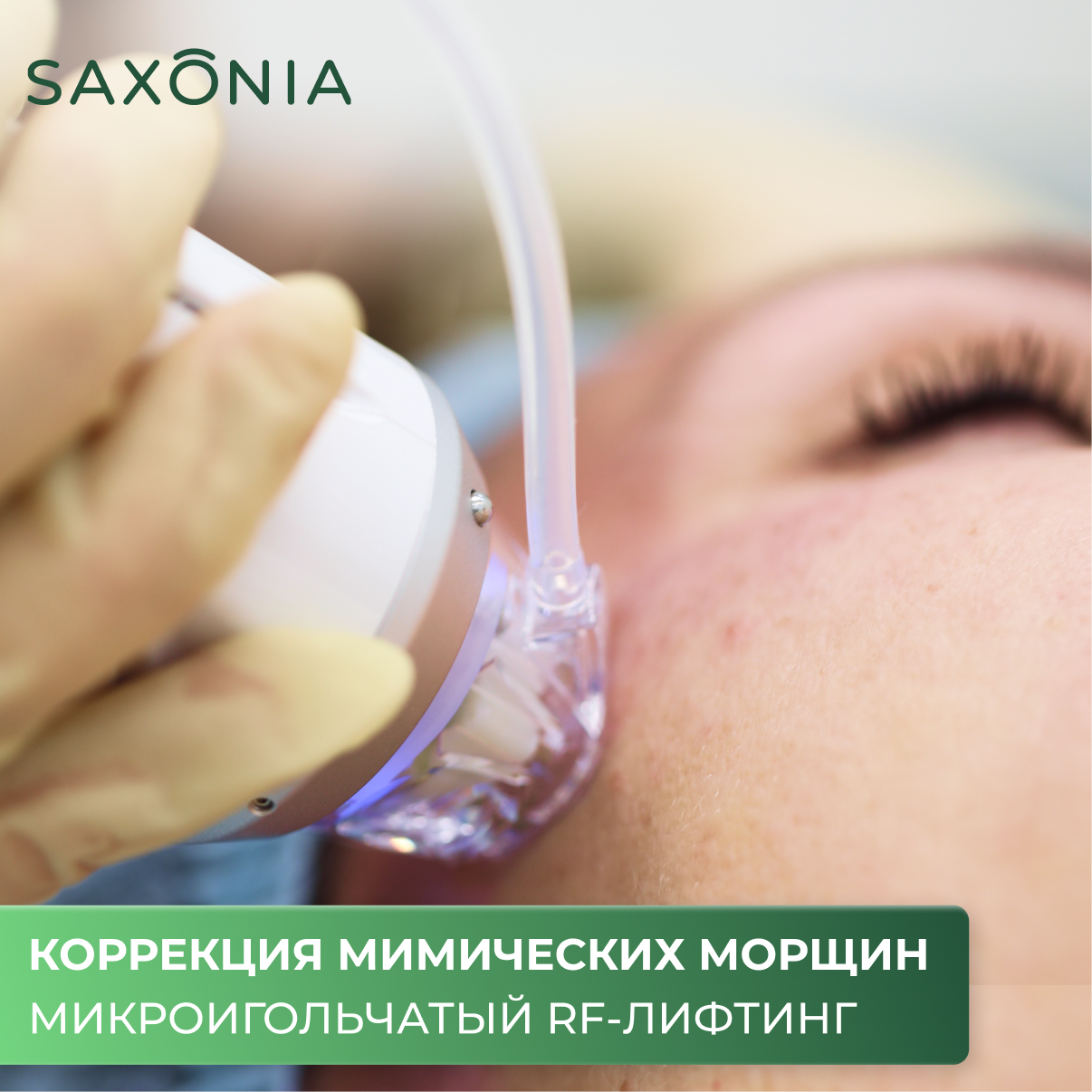 Быстрая коррекция мимических морщин без инъекций, филеров или оперативного вмешательства? – Легко!