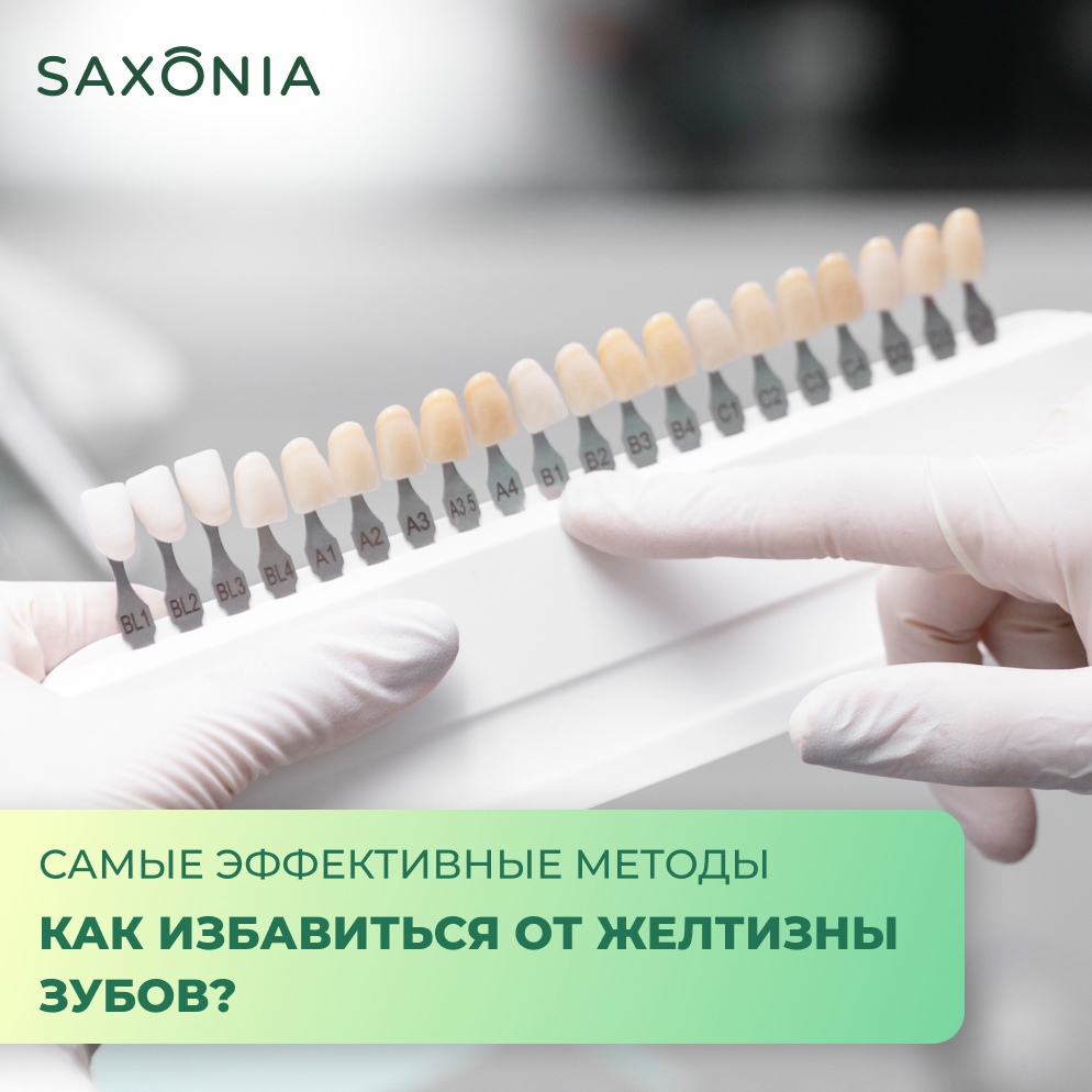 Как избавиться от желтизны зубов?