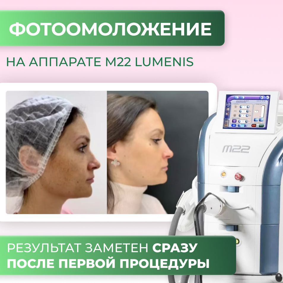 Фотоомоложение на аппарате М22 Lumenis - это естественное омоложение кожи всего за несколько сеансов!