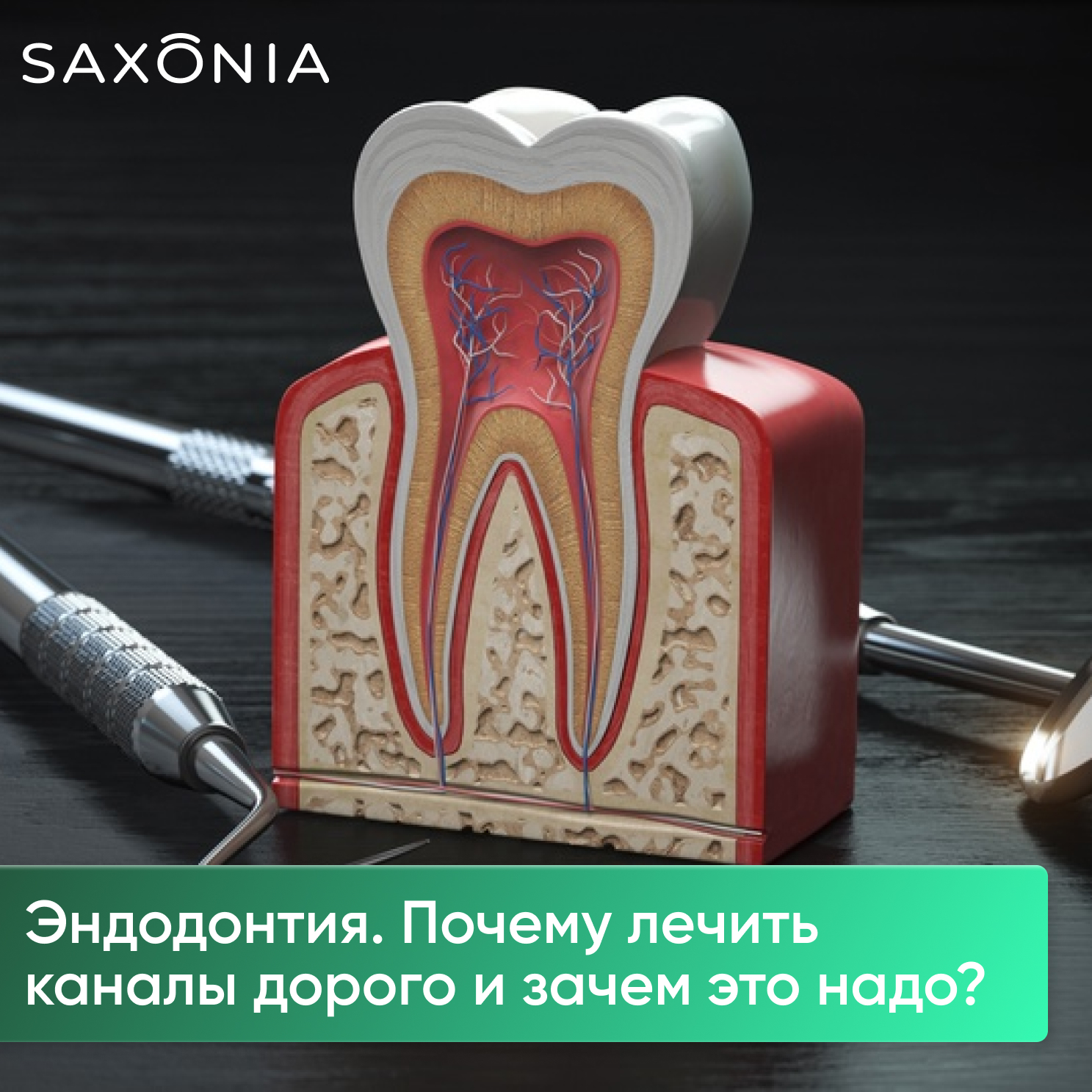 Эндодонтия. Почему лечить каналы дорого и зачем это надо?