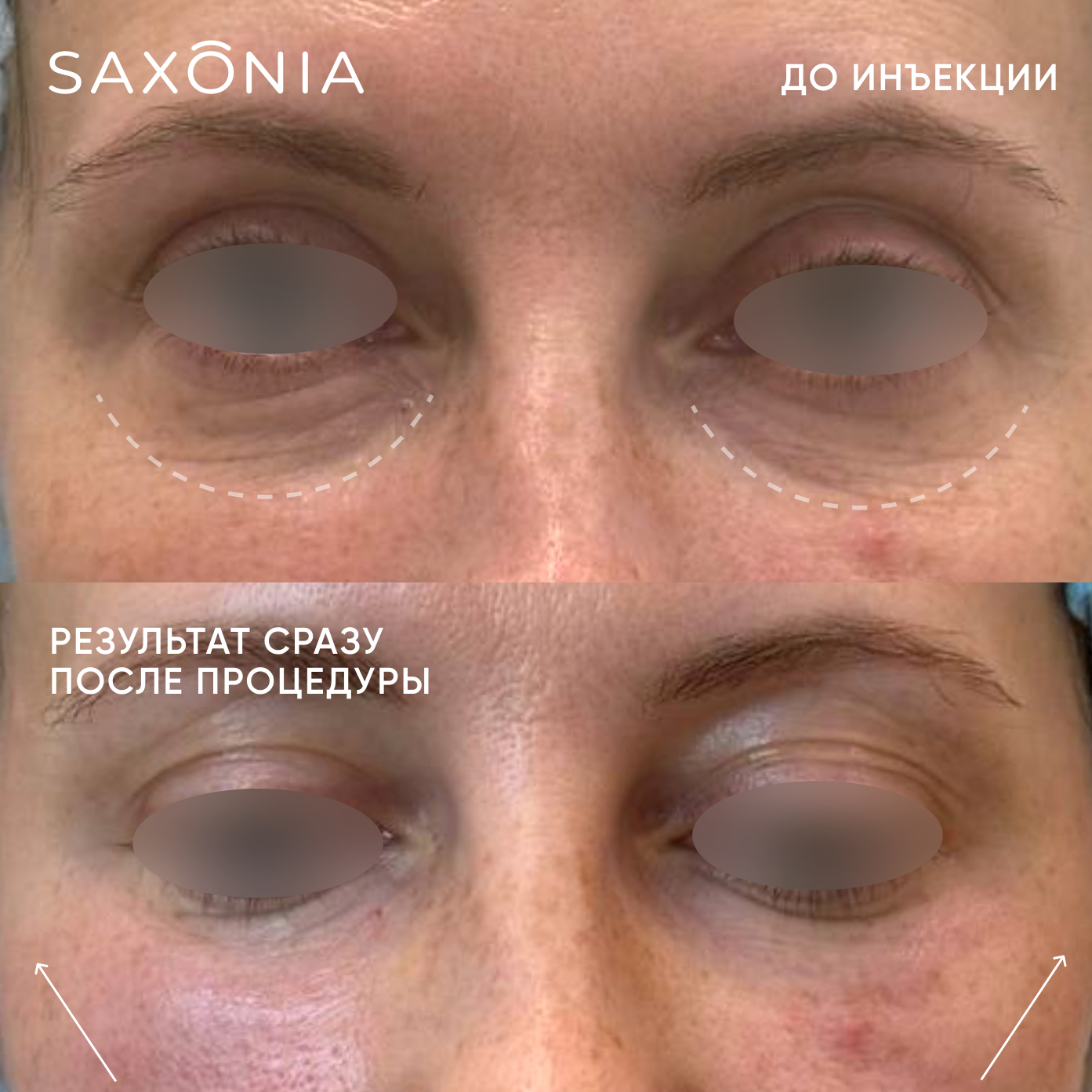 Открытый взгляд без следов усталости