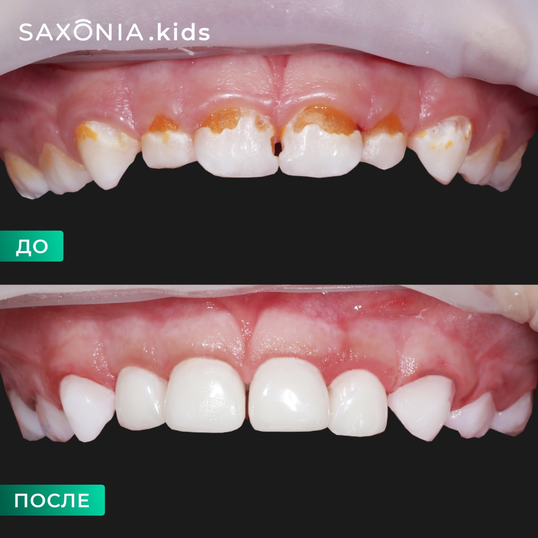 Сладкий сон для красивой и здоровой улыбки!